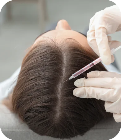 Female Hair Restoration